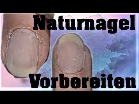 Nagelhaut entfernen: Schritt für Schritt